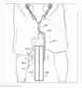 Fig. 01 - Weightlifting belt and system