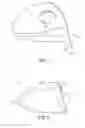 Fig. 02 - Golf club head