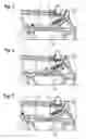 Fig. 02 - Armrest for a motor vehicle