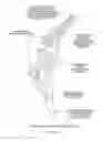 Fig. 44 - Aircraft engine mounting system and method of mounting aircraft engines