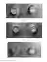 Fig. 15 - Articles having thermoset coatings and coating methods