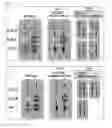 Fig. 02 - Immune-compatible cells created by nuclease-mediated editing of genes encoding HLA