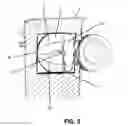 Fig. 03 - WASHABLE LAUNDRY BAG
