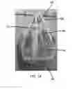 Fig. 10 - WASHABLE LAUNDRY BAG
