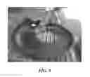 Fig. 07 - Pump liner