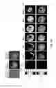 Fig. 25 - Polymer-nanostructure composition for selective molecular recognition