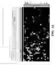 Fig. 02 - DIAGNOSTIC AND PROGNOSTIC METHODS FOR LUNG DISORDERS USING GENE EXPRESSION PROFILES FROM NOSE EPITHELIAL CELLS