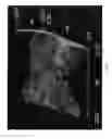 Fig. 05 - ELECTROSTATIC PRINTING APPARATUS AND INTERMEDIATE TRANSFER MEMBERS