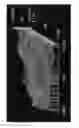 Fig. 07 - ELECTROSTATIC PRINTING APPARATUS AND INTERMEDIATE TRANSFER MEMBERS