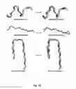 Fig. 11 - COMPUTATIONAL METHOD FOR CLASSIFYING AND PREDICTING PROTEIN SIDE CHAIN CONFORMATIONS