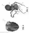 Fig. 06 - Systems and methods for determining blood flow characteristics using flow ratio