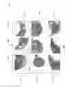 Fig. 08 - Systems and methods for automatic detection and quantification of pathology using dynamic feature classification