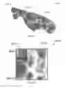 Fig. 09 - Systems and methods for automatic detection and quantification of pathology using dynamic feature classification