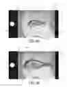 Fig. 04 - Systems and associated methods for measuring the length of a fish