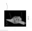 Fig. 07 - Three-dimensional cardiac representation