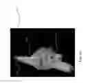 Fig. 09 - Three-dimensional cardiac representation