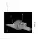Fig. 10 - Three-dimensional cardiac representation