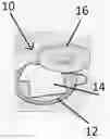 Fig. 01 - STOVETOP HEAT MANAGEMENT SYSTEM