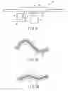 Fig. 03 - Insertion device