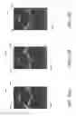 Fig. 37 - Medical devices, systems, and methods for performing eye exams and eye tracking