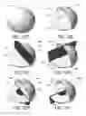 Fig. 40 - Medical devices, systems, and methods for performing eye exams and eye tracking