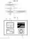 Fig. 06 - Fundus imaging apparatus and imaging method