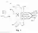 Fig. 02 - System and method for determination of transpulmonary pressure in a patient connected to a breathing apparatus