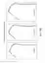 Fig. 44 - METHODS AND SYSTEMS FOR DETERMINING VASCULAR BODILY LUMEN INFORMATION AND GUIDING MEDICAL DEVICES
