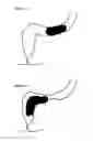 Fig. 02 - Apparatus for testing distal colonic and anorectal function