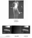 Fig. 02 - Radiograph density detection device