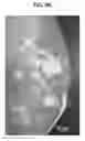 Fig. 08 - Miniaturized Phantoms for Quantitative Image Analysis and Quality Control