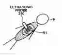 Fig. 01 - Support apparatus and support method