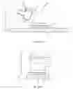 Fig. 33 - Vascular closure device