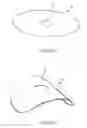 Fig. 40 - Vascular closure device