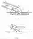 Fig. 41 - Vascular closure device