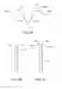 Fig. 06 - Devices and methods for securing medical devices with an anatomy