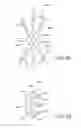 Fig. 08 - Devices and methods for securing medical devices with an anatomy
