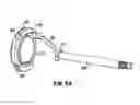 Fig. 06 - Apparatus and method for tissue closure