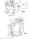 Fig. 08 - Apparatus and method for tissue closure