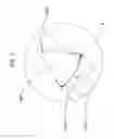Fig. 05 - Microstructure-based systems, apparatus, and methods for wound closure