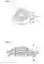 Fig. 02 - Endoscopic treatment tool