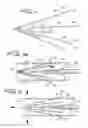 Fig. 03 - Vascular device and method for valve leaflet apposition