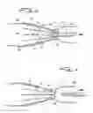 Fig. 04 - Vascular device and method for valve leaflet apposition