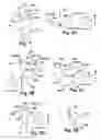 Fig. 02 - Method and apparatus for substantially blocking bloodflow through a dissected aorta