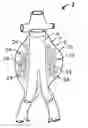 Fig. 01 - EMBOLIZATION DEVICE AND A METHOD OF USING THE SAME