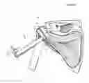 Fig. 01 - Method of Humeral Head Resurfacing and/or Replacement and System for Accomplishing the Method
