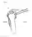 Fig. 07 - Method of Humeral Head Resurfacing and/or Replacement and System for Accomplishing the Method