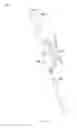 Fig. 07 - Notched apparatus for guidance of an insertable instrument along an axis during spinal surgery
