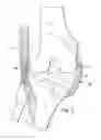 Fig. 03 - System and method for load balancing in knee replacement procedures