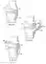 Fig. 04 - System and method for load balancing in knee replacement procedures